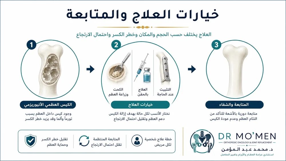 علاج الكيس العظمي التمددي بين الكحت والحقن والتثبيت حسب خطر الكسر علاج الكيس العظمي التمددي بين الكحت والحقن والتثبيت حسب خطر الكسر
