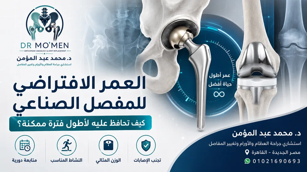 العمر الافتراضي للمفصل الصناعي: كيف تحافظ عليه لأطول فترة ممكنة؟