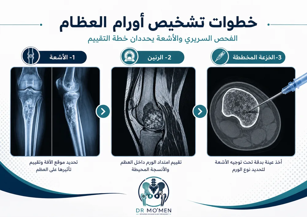 خطة علاج أورام العظام حسب نوع الورم ومكانه ودرجة الخطورة خطة علاج أورام العظام حسب نوع الورم ومكانه ودرجة الخطورة