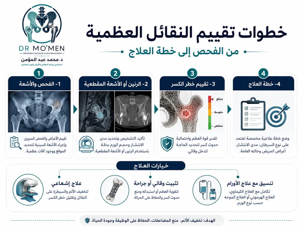 علاج النقائل العظمية بين التثبيت والإشعاع والعلاج الدوائي علاج النقائل العظمية بين التثبيت والإشعاع والعلاج الدوائي