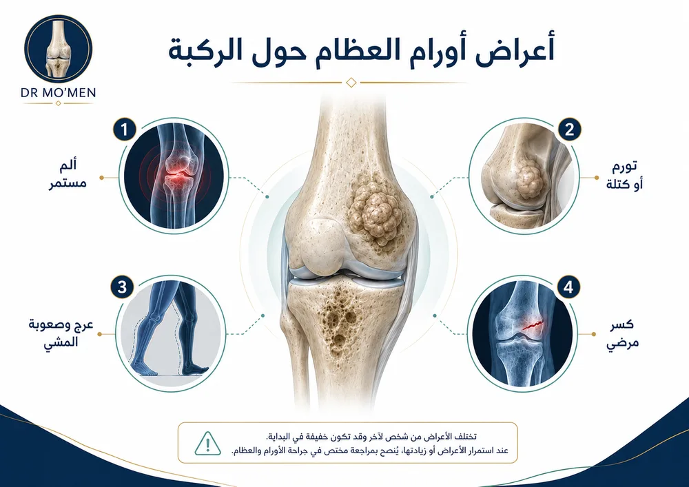 تشخيص أورام الركبة بالأشعة والرنين لتحديد علاقة الورم بالمفصل