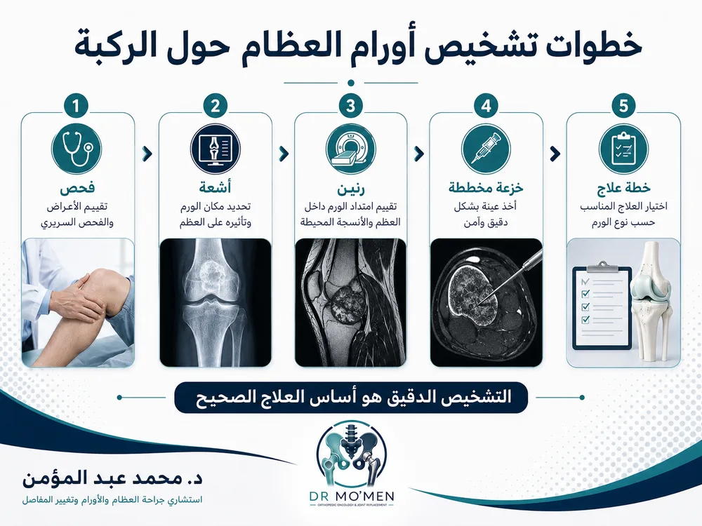 علاج أورام العظام حول الركبة مع الحفاظ على المفصل والحركة قدر الإمكان