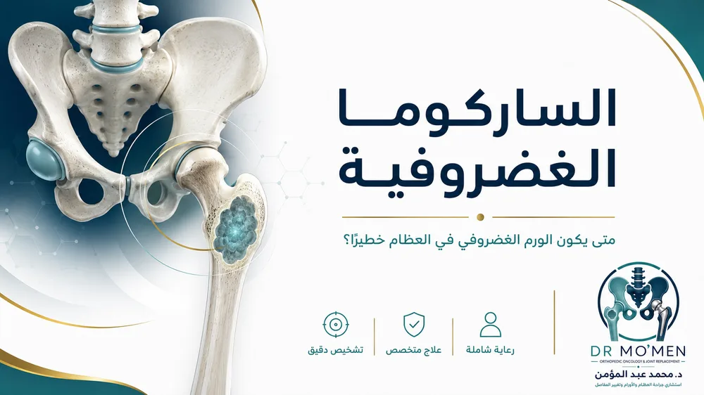 الساركوما الغضروفية Chondrosarcoma: متى يكون الورم الغضروفي في العظام خطيرًا؟
