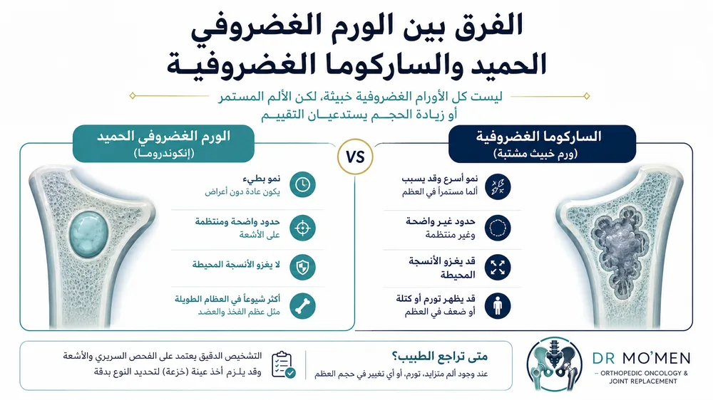 الفرق بين الورم الغضروفي الحميد والساركوما الغضروفية في العظام