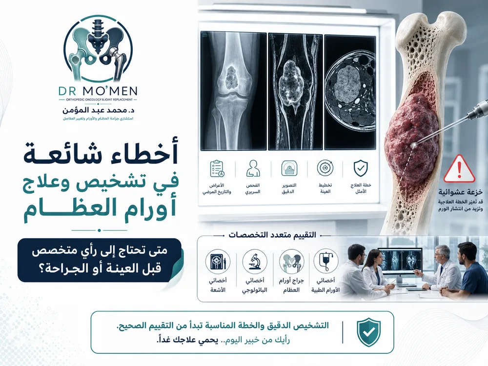 أخطاء شائعة في تشخيص وعلاج أورام العظام قد تؤثر على فرص العلاج