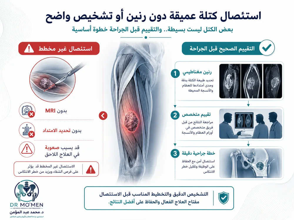 استئصال كتلة عميقة دون رنين قد يؤدي إلى علاج غير مكتمل استئصال كتلة عميقة دون رنين قد يؤدي إلى علاج غير مكتمل