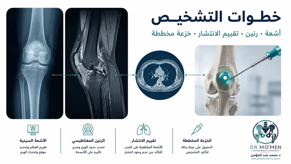 تشخيص الساركوما العظمية بالرنين وCT وPET-CT والخزعة المخططة