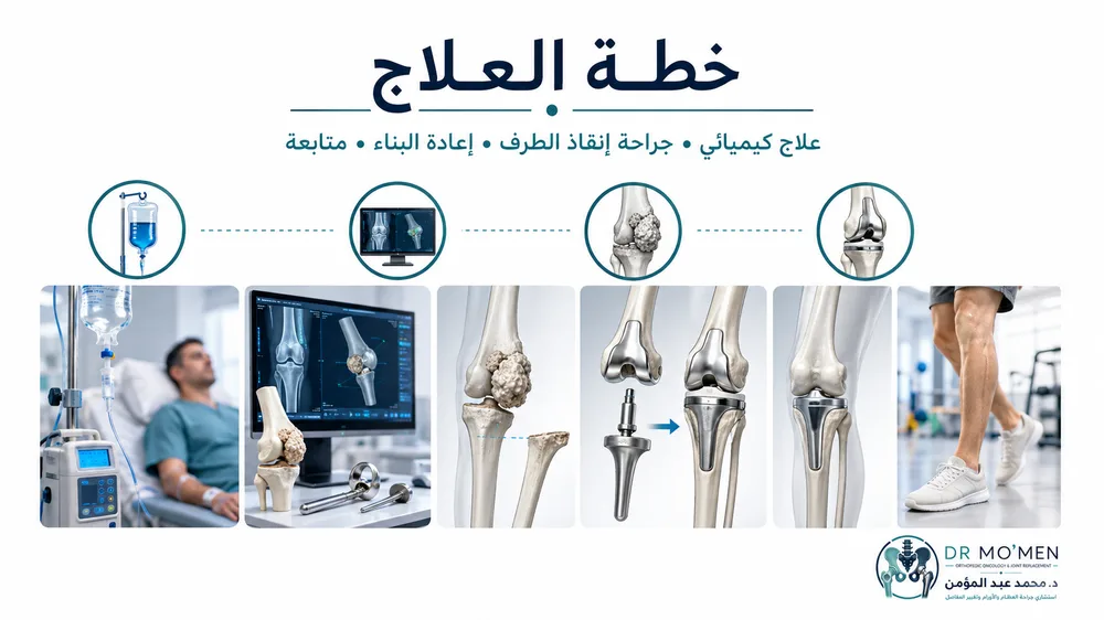 خطة علاج الساركوما العظمية بين العلاج الكيميائي وجراحة إنقاذ الطرف