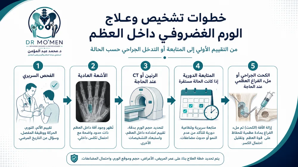 تشخيص الورم الغضروفي داخل العظم بالأشعة والرنين عند الاشتباه تشخيص الورم الغضروفي داخل العظم بالأشعة والرنين عند الاشتباه
