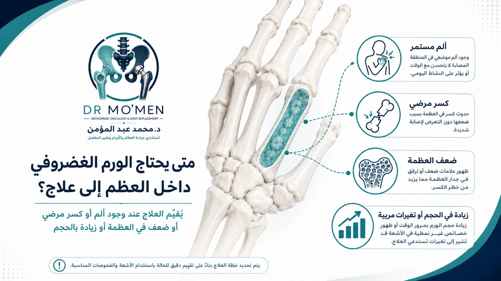 علاج Enchondroma بين المتابعة والكحت وملء الفراغ العظمي علاج Enchondroma بين المتابعة والكحت وملء الفراغ العظمي