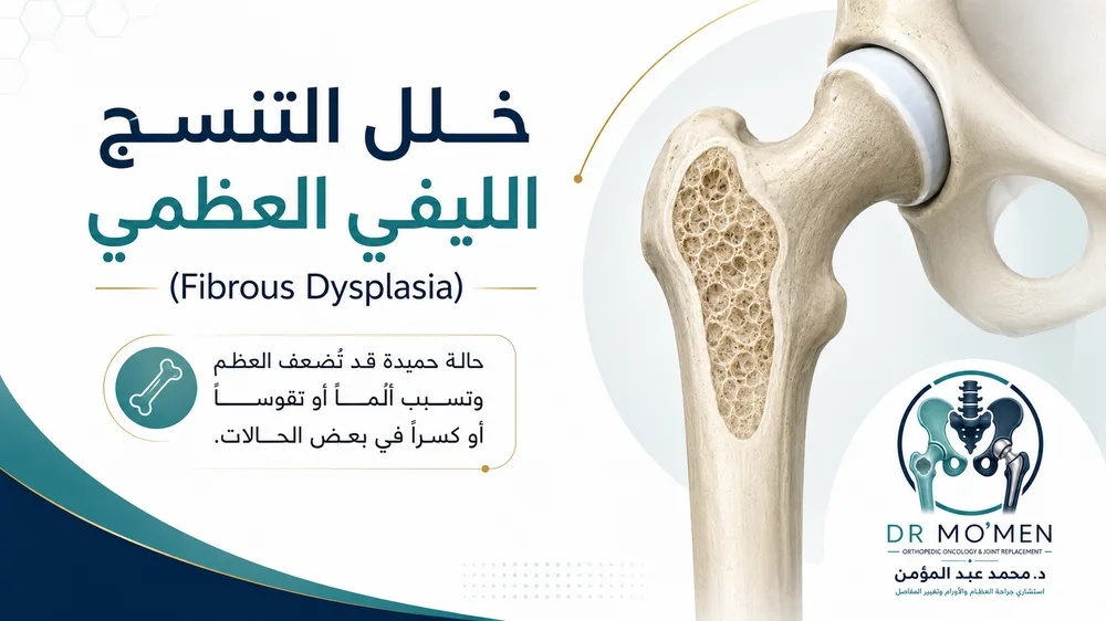 خلل التنسج الليفي العظمي Fibrous Dysplasia: متى يكون ألم العظام أو التقوس علامة تحتاج إلى تقييم متخصص؟