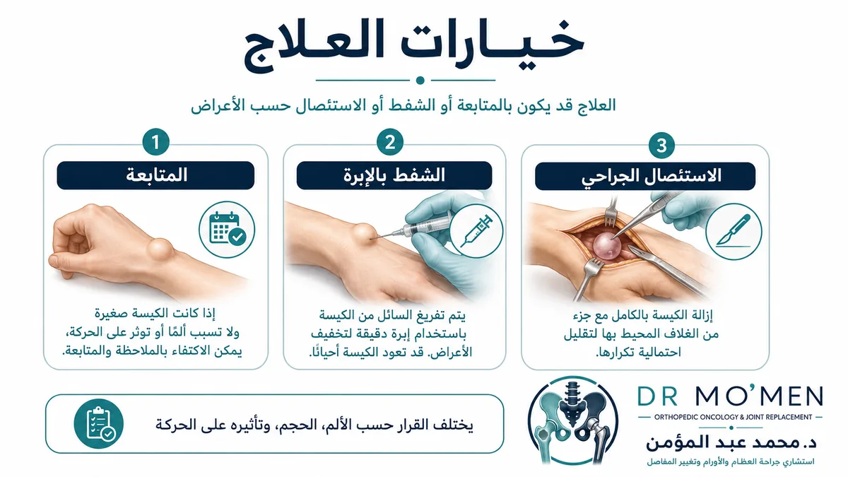 علاج الكيس الزلالي بين المتابعة والشفط والجراحة علاج الكيس الزلالي بين المتابعة والشفط والجراحة