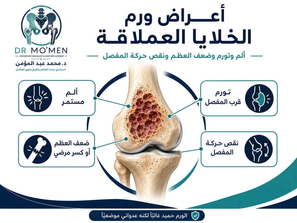 تشخيص ورم الخلايا العملاقة بالرنين والأشعة قبل اختيار العلاج