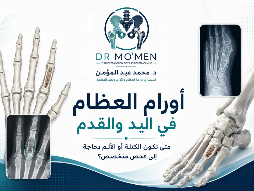 أورام العظام في اليد والقدم: متى تكون الكتلة أو الألم بحاجة إلى فحص متخصص؟
