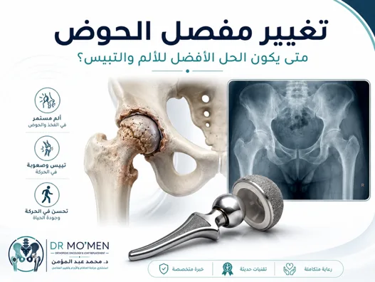 تغيير مفصل الفخذ: متى يكون الحل الأفضل للألم والتيبس؟