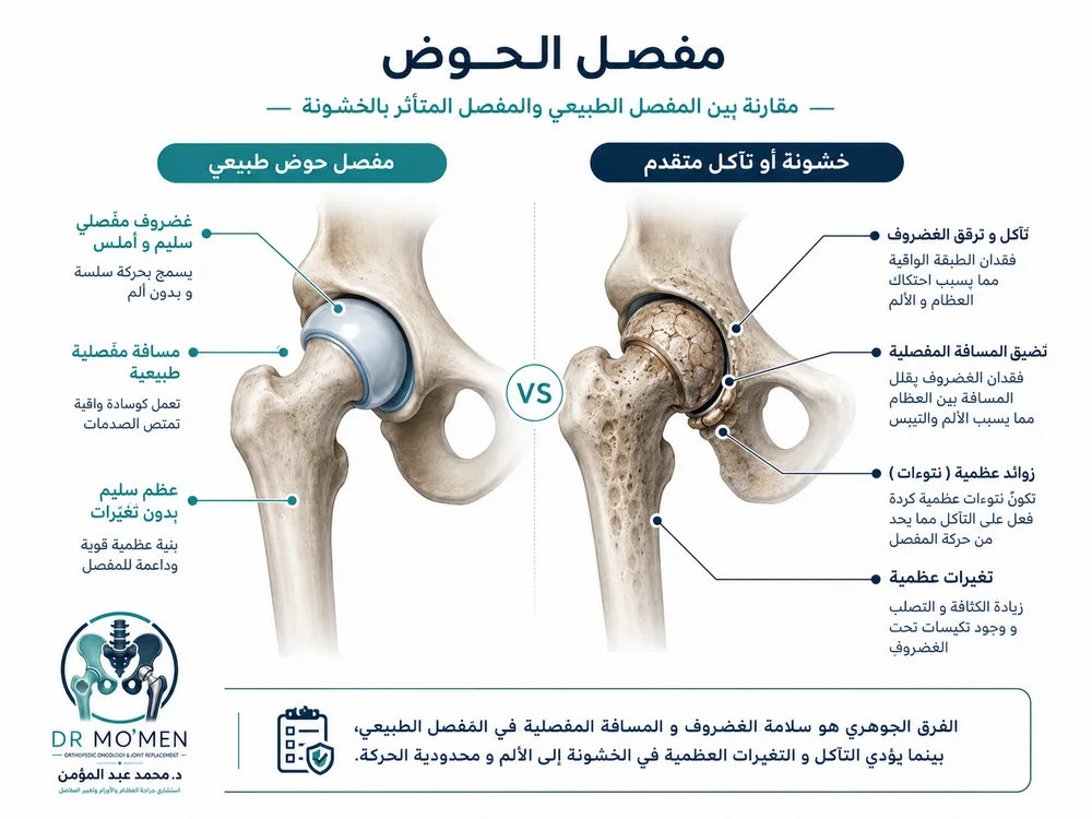 ألم الفخذ والحوض وصعوبة المشي من علامات تدهور مفصل الفخذ ألم الفخذ والحوض وصعوبة المشي من علامات تدهور مفصل الفخذ