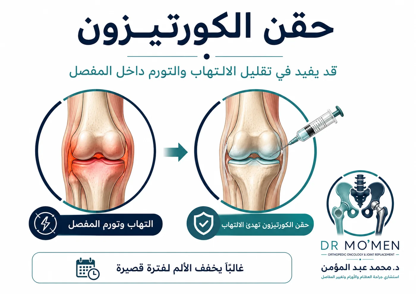 حقن الكورتيزون للركبة لتقليل الالتهاب والتورم حقن الكورتيزون للركبة لتقليل الالتهاب والتورم