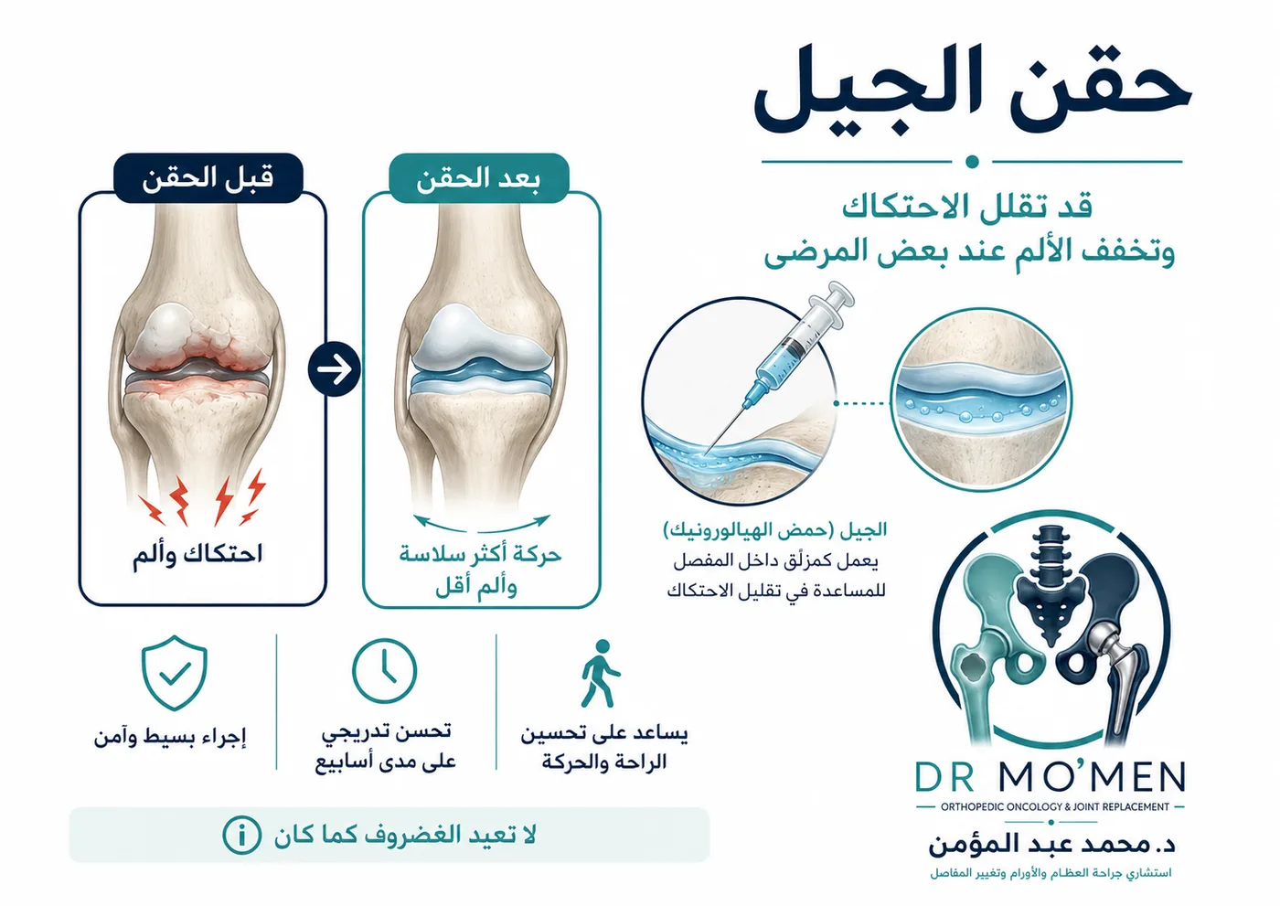 حقن الجيل للركبة أو حمض الهيالورونيك في خشونة الركبة حقن الجيل للركبة أو حمض الهيالورونيك في خشونة الركبة
