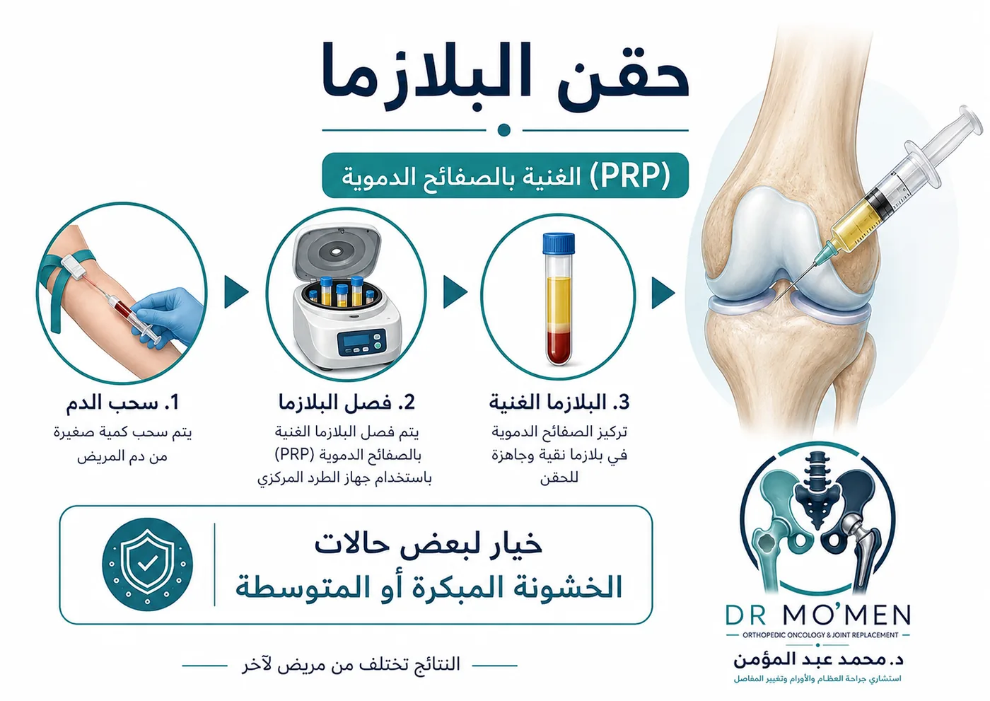 حقن البلازما للركبة في خشونة الركبة المبكرة والمتوسطة حقن البلازما للركبة في خشونة الركبة المبكرة والمتوسطة