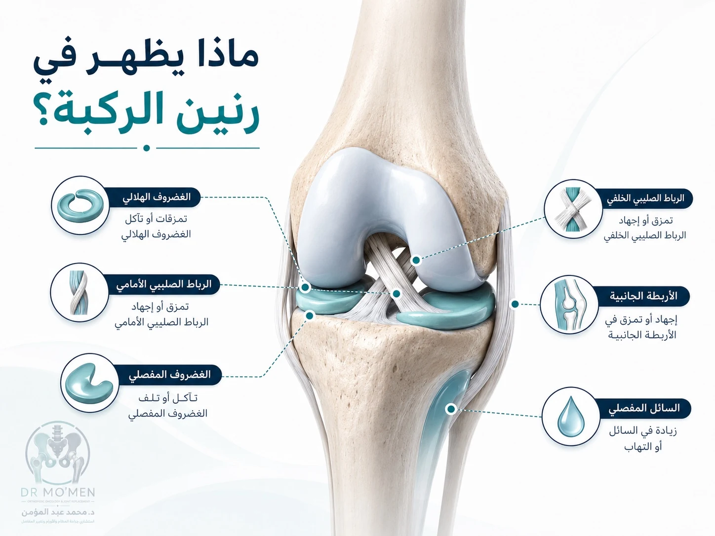 رسم تشريحي يوضح أجزاء الركبة التي تظهر في الرنين مثل الغضروف الهلالي والرباط الصليبي