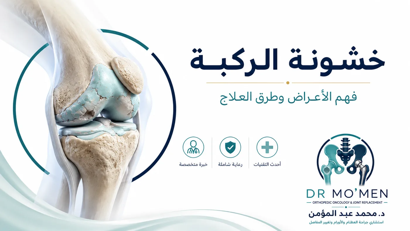 خشونة الركبة: متى تكفي الأدوية والحقن؟ ومتى نحتاج تغيير مفصل؟