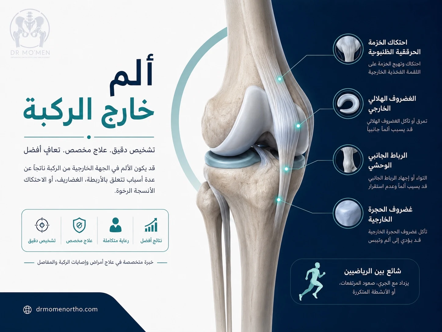 إنفوجرافيك يوضح أسباب ألم خارج الركبة مثل احتكاك الشريط الحرقفي والغضروف الخارجي