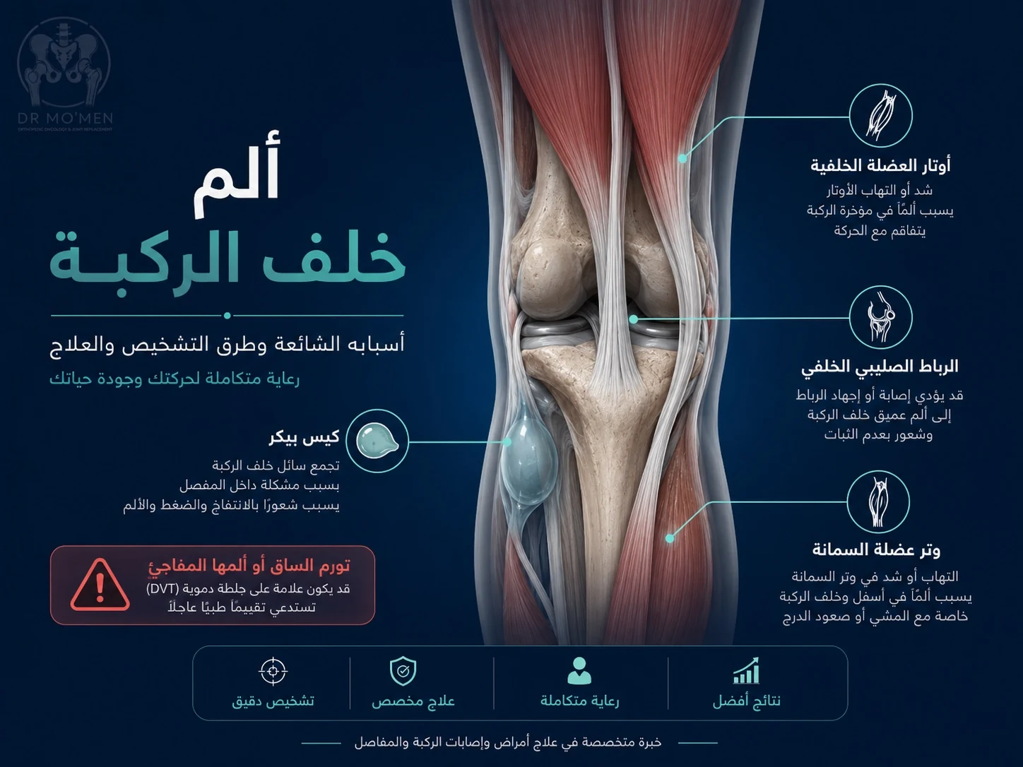 رسم طبي يوضح أسباب ألم خلف الركبة مثل كيس بيكر وأوتار خلف الركبة وعلامات الجلطة