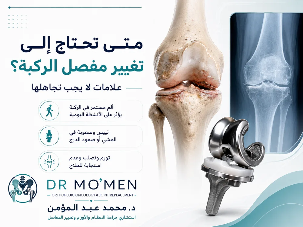 متى تحتاج إلى تغيير مفصل الركبة؟ علامات لا يجب تجاهلها