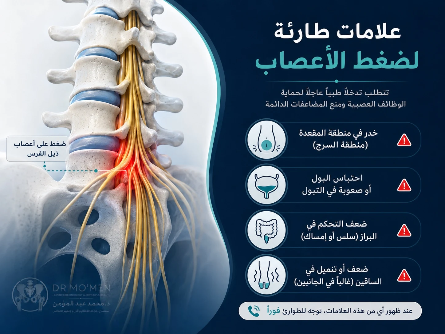 رسم طبي يوضح علامات متلازمة ذيل الفرس مثل تنميل منطقة المقعدة ومشاكل البول