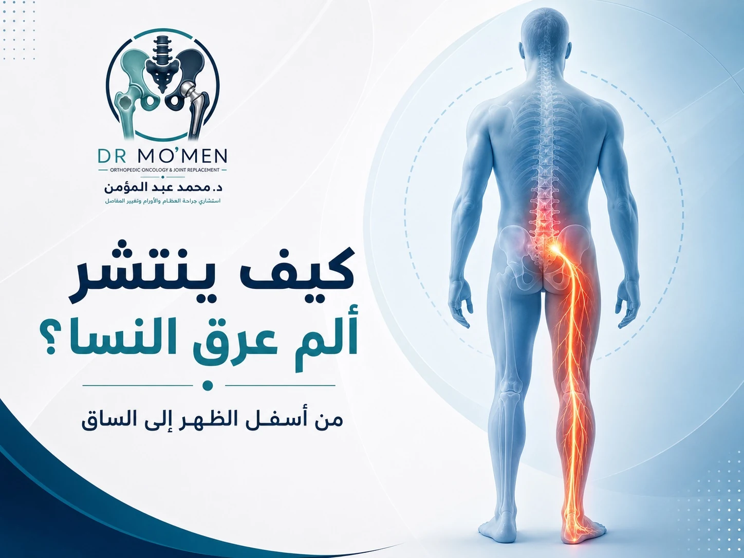 مسار ألم عرق النسا من أسفل الظهر إلى الساق
