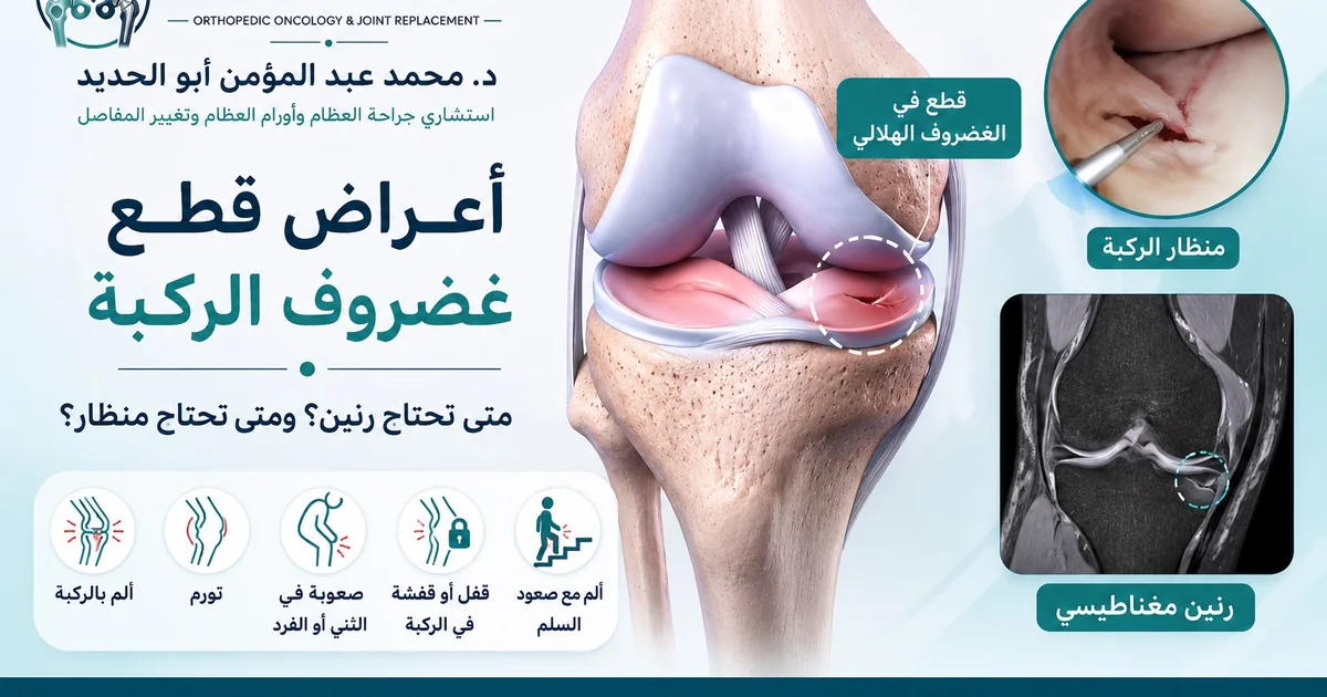 أعراض قطع غضروف الركبة ومتى تحتاج رنين أو منظار لعلاج الغضروف الهلالي