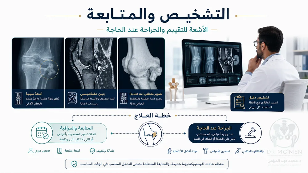 تشخيص الزائدة العظمية بالأشعة والرنين قبل قرار الاستئصال