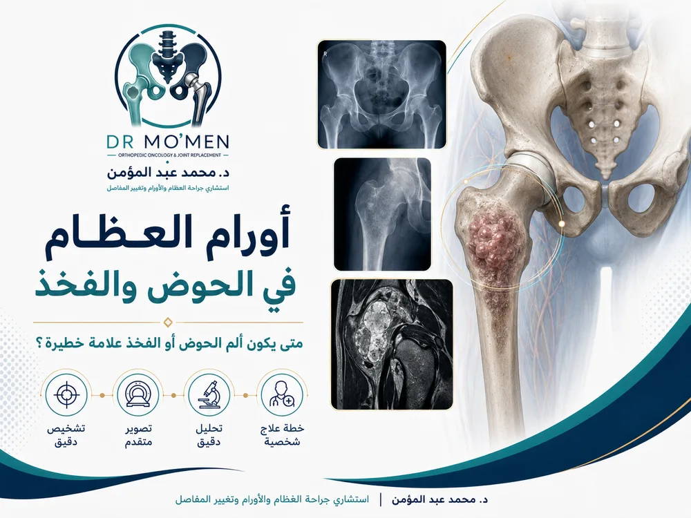 أورام العظام في الحوض والفخذ: متى يكون ألم الحوض أو الفخذ علامة خطيرة؟