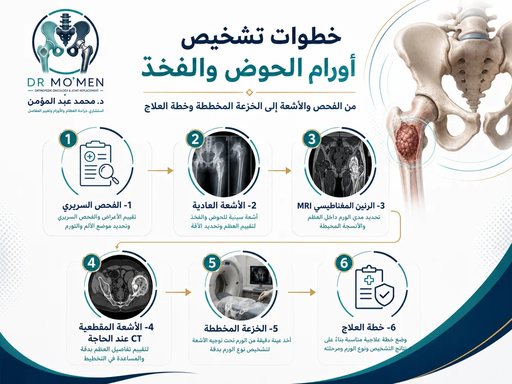 علاج أورام الحوض والفخذ مع تقييم خطر الكسر وإعادة البناء علاج أورام الحوض والفخذ مع تقييم خطر الكسر وإعادة البناء