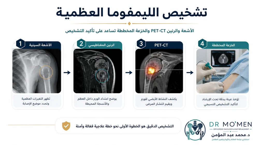 تشخيص الليمفوما العظمية بالرنين وPET-CT والخزعة المخططة تشخيص الليمفوما العظمية بالرنين وPET-CT والخزعة المخططة