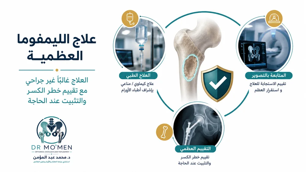 علاج الليمفوما العظمية داخل فريق متخصص مع تقييم خطر الكسر علاج الليمفوما العظمية داخل فريق متخصص مع تقييم خطر الكسر
