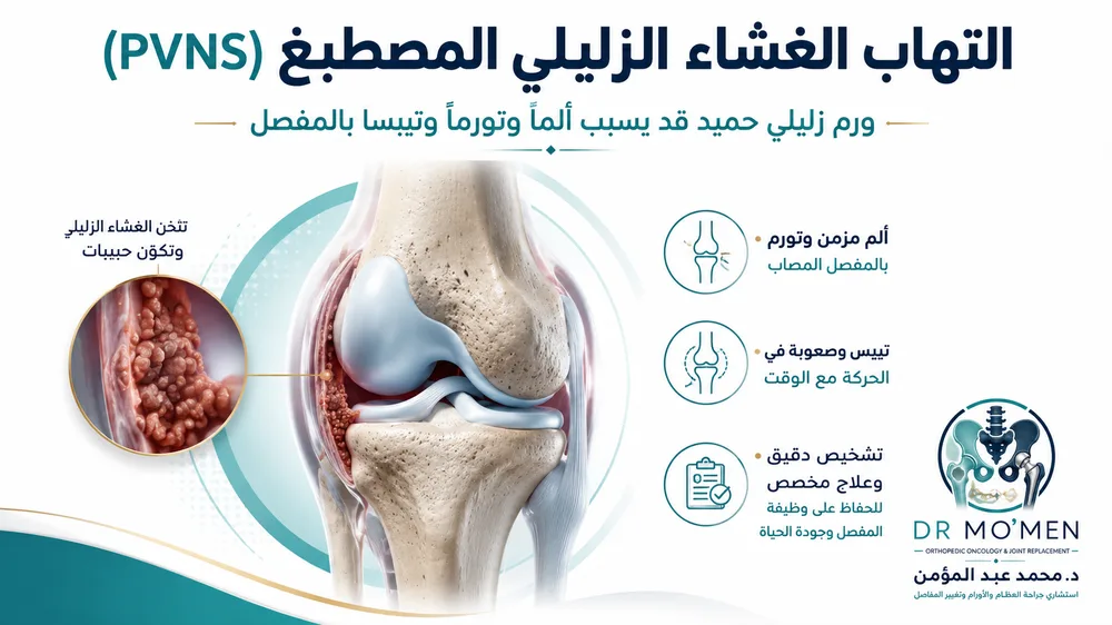 ورم الغشاء الزليلي الزغابي المصطبغ PVNS / TGCT: المنظار أم الجراحة المفتوحة؟