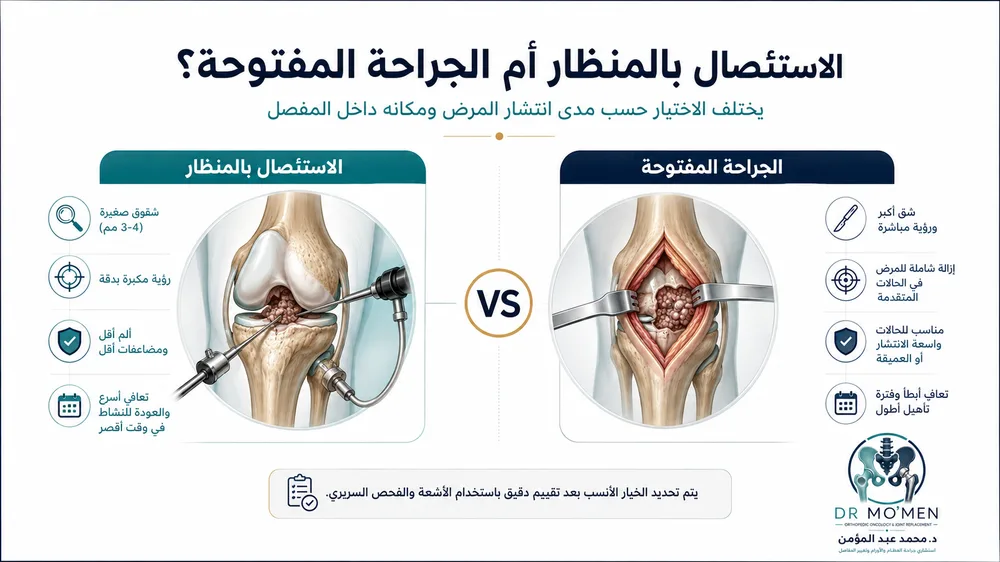 الفرق بين المنظار والجراحة المفتوحة لعلاج PVNS أو TGCT الفرق بين المنظار والجراحة المفتوحة لعلاج PVNS أو TGCT