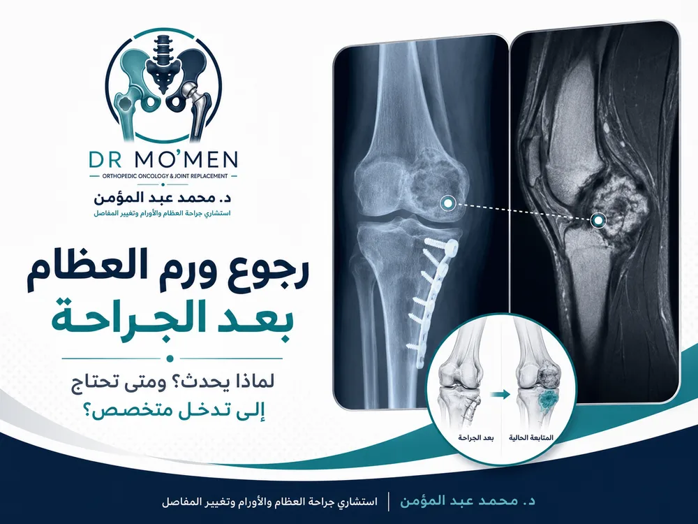 رجوع ورم العظام بعد الجراحة: لماذا يحدث؟ ومتى تحتاج إلى تدخل متخصص؟