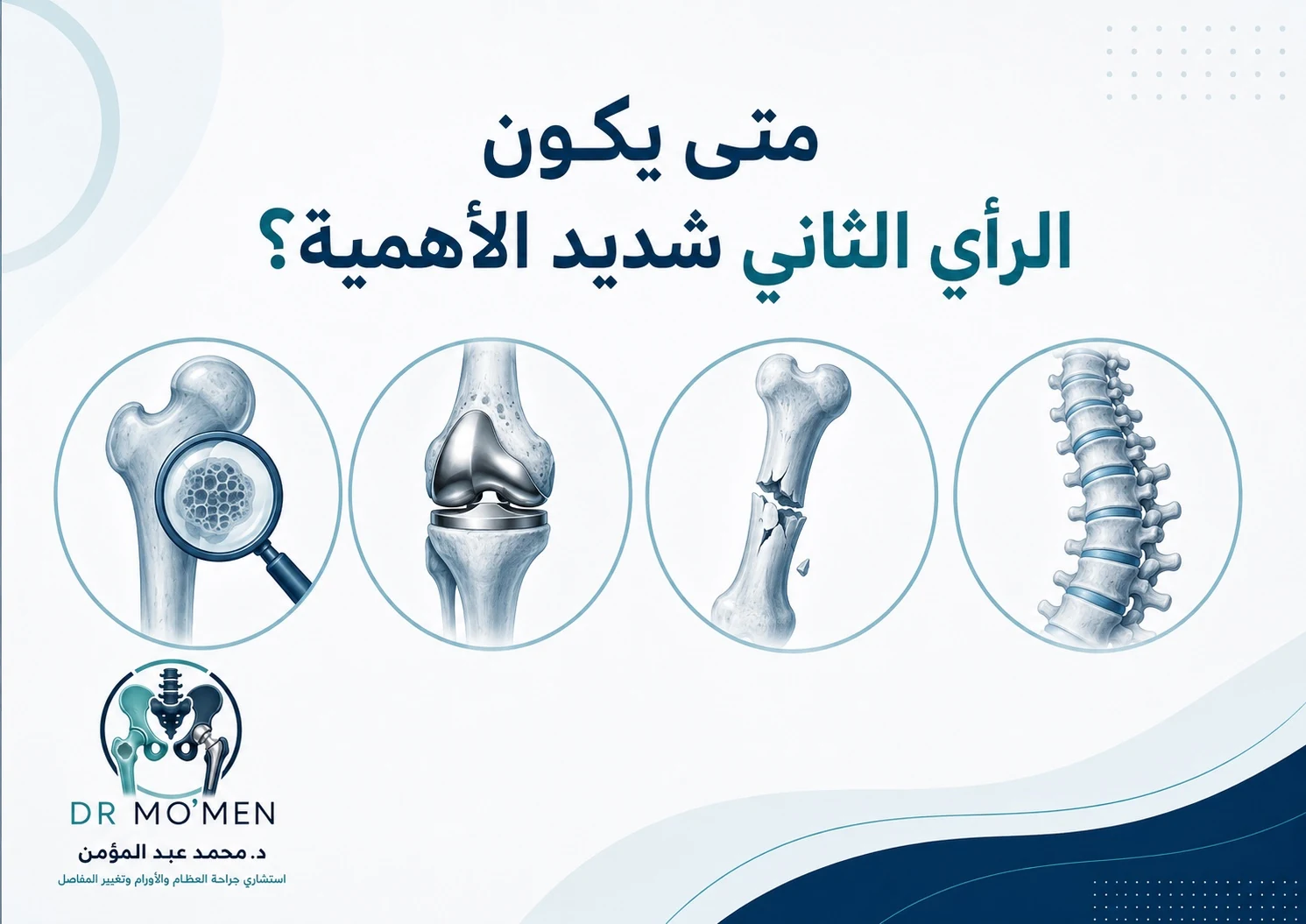 إنفوجرافيك يوضح الحالات التي تستدعي الرأي الطبي الثاني في العظام والأورام