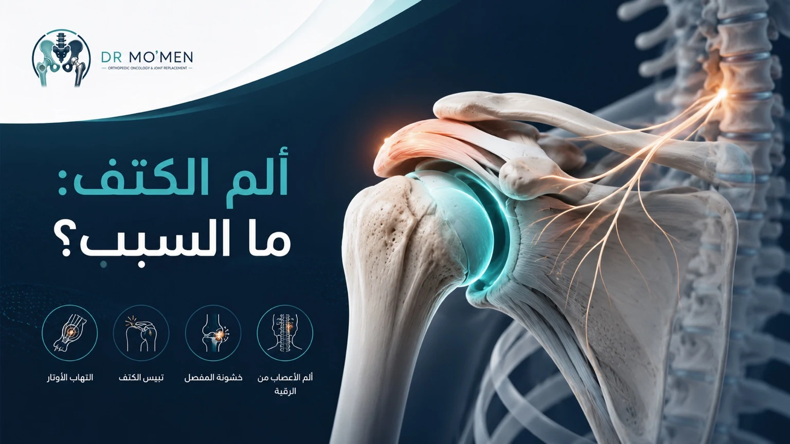 رسم طبي يوضح أسباب ألم الكتف مثل التهاب الأوتار والكتف المتجمد وألم الرقبة