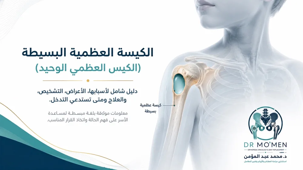 الكيس العظمي البسيط Simple Bone Cyst: هل هو ورم؟ ومتى يسبب كسرًا أو يحتاج إلى جراحة؟