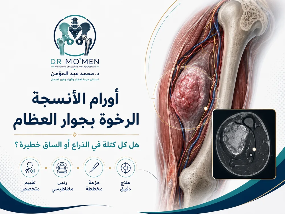 أورام الأنسجة الرخوة بجوار العظام: هل كل كتلة في الذراع أو الساق خطيرة؟