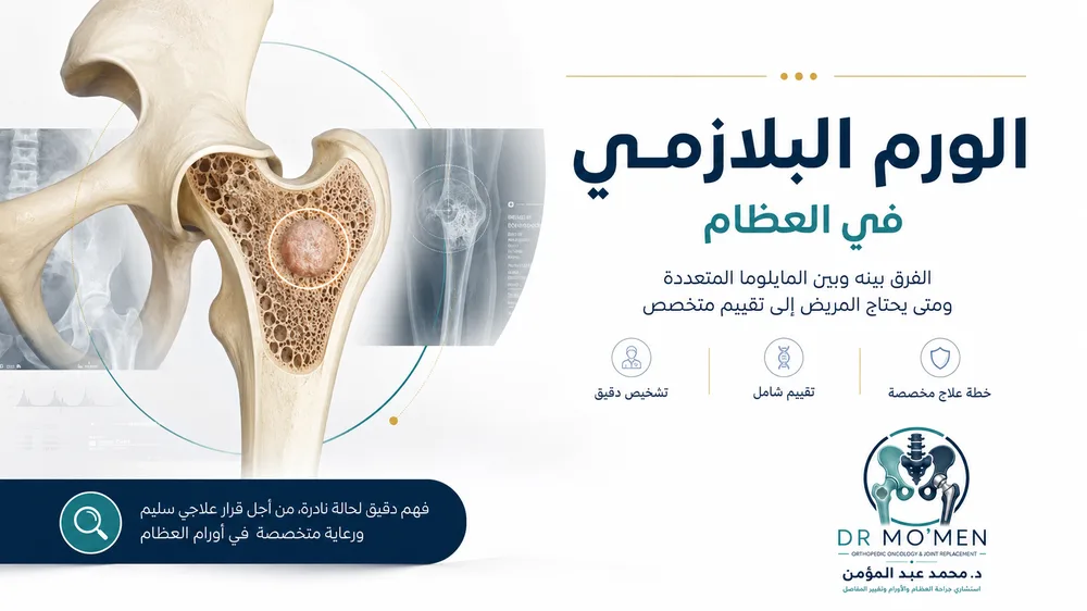 الورم البلازمي في العظام: الفرق بينه وبين المايلوما المتعددة ومتى يحتاج المريض إلى تقييم متخصص