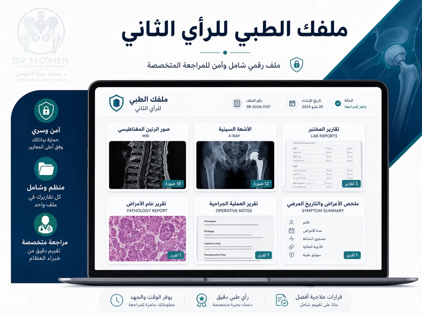 ملف رقمي منظم للأشعات والتقارير قبل الرأي الطبي الثاني في العظام