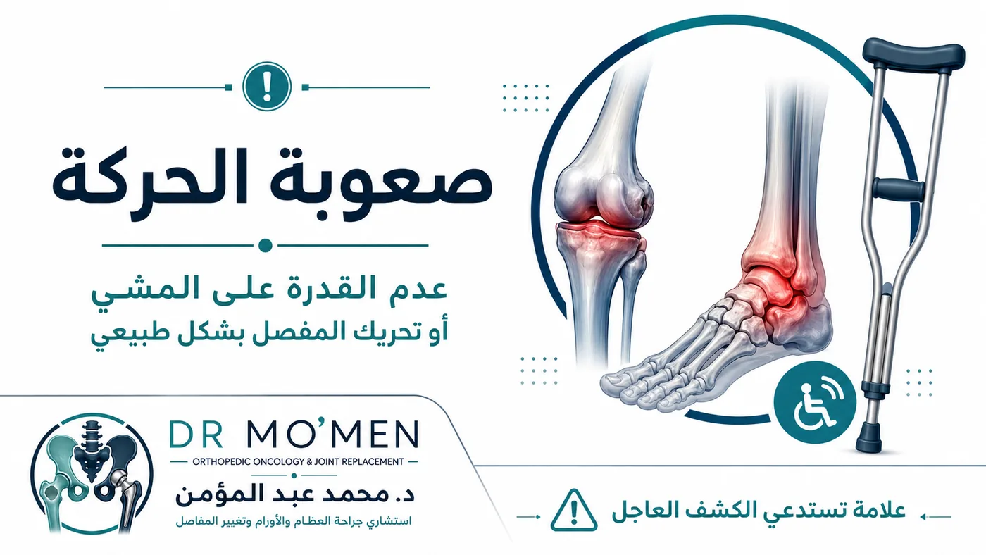 صعوبة المشي أو تحريك المفصل بشكل طبيعي بعد الإصابة من علامات الحاجة إلى كشف عظام عاجل