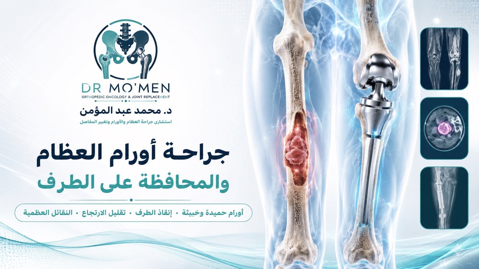 Bone tumor surgery and limb preservation