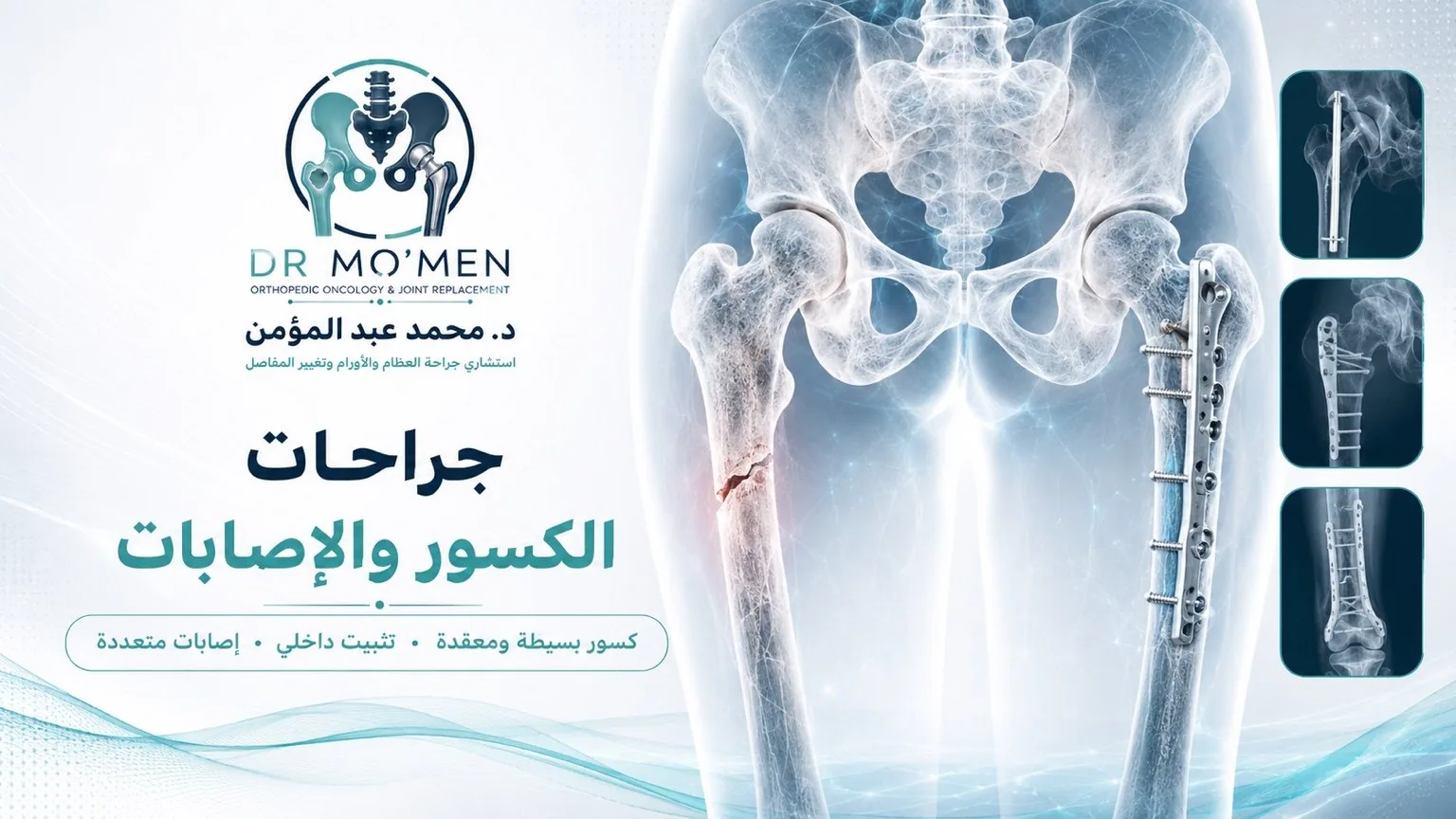 د. محمد أبو الحديد — جراحات الكسور والإصابات في مصر الجديدة، القاهرة